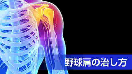 野球肩を治す方法 - 投げて痛めた肩の治し方講座 | 講師: 寺川 一秀